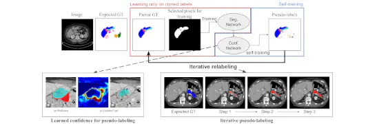 INNERANT grahical abstract